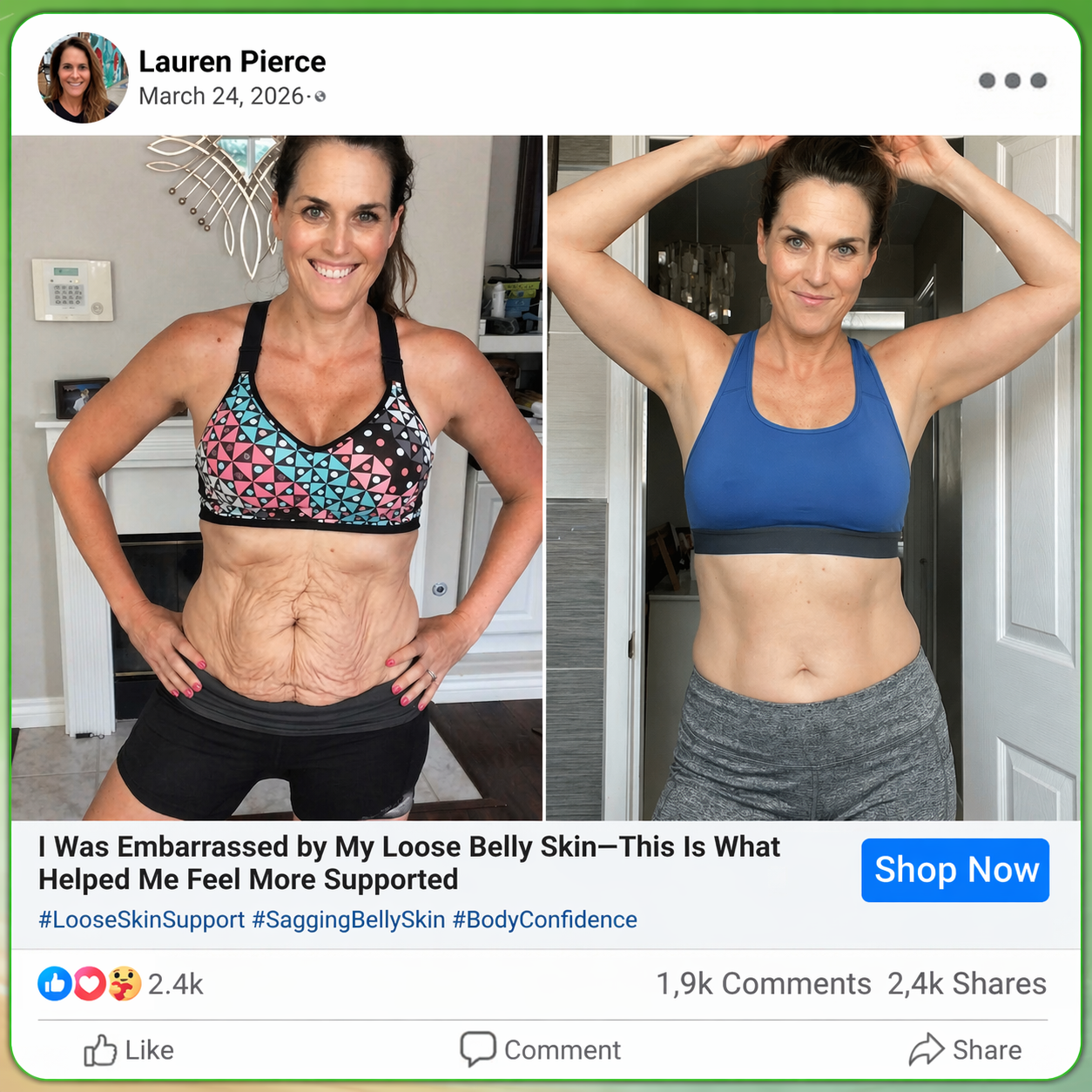𝑶𝒇𝒇𝒊𝒄𝒊𝒂𝒍 𝑺𝒕𝒐𝒓𝒆  | 👩‍⚕️🌲𝐂𝐚𝐫𝐞𝐔𝐩𝐥𝐢𝐟𝐭®𝑴𝒐𝒓𝒊𝒏𝒈𝗮 · 𝗕𝗲𝗿𝗯𝗲𝗿𝙞𝙣𝙚 × 𝙉𝘼𝐃+ 𝟏𝟎-𝐢𝐧-𝟏 𝗔𝗱𝘃𝗮𝗻𝗰𝙚𝙙 𝙉𝙖𝙣𝙤 𝙈𝙞𝙘𝙧𝙤𝙣𝙚𝙚𝐝𝐥𝐞 𝐏𝐚𝐭𝙘𝙝(𝐉𝐮𝐬𝐭 𝐨𝐧𝐜𝐞 𝐚 𝐝𝐚𝐲, 𝐯𝐢𝐬𝐢𝐛𝐥𝐞 𝐜𝐡𝐚𝐧𝐠𝐞𝐬 𝐢𝐧 𝟕 𝐝𝐚𝐲𝐬） ✅ 𝐅𝐨𝐫 𝐨𝐛𝐞𝐬𝐢𝐭𝐲, 🅛🅞🅞🅢🅔 🅢🅚🅘🅝,𝐝𝐢𝐚𝐛𝐞𝐭𝐞𝐬, 𝐬𝐥𝐞𝐞𝐩 𝐚𝐩𝐧𝐞𝐚, 𝐣𝐨𝐢𝐧𝐭 𝐢𝐬𝐬𝐮𝐞𝐬, 𝐚𝐧𝐝 𝐦𝐨𝐫𝐞