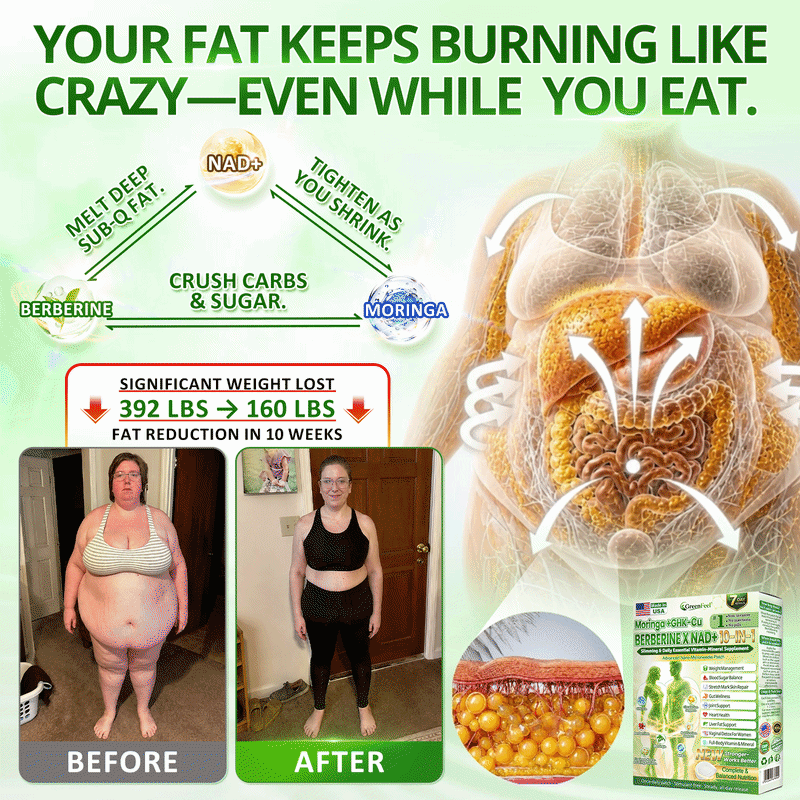 𝑶𝒇𝒇𝒊𝒄𝒊𝒂𝒍 𝑺𝒕𝒐𝒓𝒆 | 𝐍𝐞𝐰!🍀🍀𝐂𝐚𝐫𝐞𝐔𝐩𝐥𝐢𝐟𝐭® 𝐁𝐫𝐨𝐰𝐧 𝐒𝐞𝐚𝐰𝐞𝐞𝐝× 𝐁𝐞𝐫𝐛𝐞𝐫𝐢𝐧𝐞× 𝐍𝐃𝐀+ 𝟏𝟎-𝐢𝐧-𝟏 𝐍𝐚𝐧𝐨 𝐌𝐢𝐜𝐫𝐨𝐧𝐞𝐞𝐝𝐥𝐞 𝐍𝐮𝐭𝐫𝐢𝐭𝐢𝐨𝐧 𝐏𝐚𝐭𝐜𝐡 🇺🇸 (𝐉𝐮𝐬𝐭 𝐨𝐧𝐜𝐞 𝐚 𝐝𝐚𝐲, 𝐯𝐢𝐬𝐢𝐛𝐥𝐞 𝐜𝐡𝐚𝐧𝐠𝐞𝐬 𝐢𝐧 𝟕 𝐝𝐚𝐲𝐬）𝘽𝙚𝙧𝙗𝙚𝙧𝙞𝙣𝙚 + 𝙈𝙤𝙧𝙞𝙣𝙜𝙖 𝙁𝙤𝙧𝙢𝙪𝙡𝙖 ✅ 𝐅𝐨𝐫 𝐨𝐛𝐞𝐬𝐢𝐭𝐲, 𝗟𝗼𝗼𝘀𝗲 𝘀𝗸𝗶𝗻,𝐝𝐢𝐚𝐛𝐞𝐭𝐞𝐬, 𝐬𝐥𝐞𝐞𝐩 𝐚𝐩𝐧𝐞𝐚, 𝐣𝐨𝐢𝐧𝐭 𝐢𝐬𝐬𝐮𝐞𝐬, 𝐚𝐧𝐝 𝐦𝐨𝐫𝐞💯💯